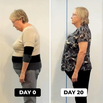 SpineAlign™ - Posture Corrector for Women and Men