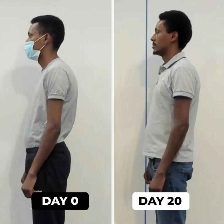 SpineAlign™ - Posture Corrector for Women and Men